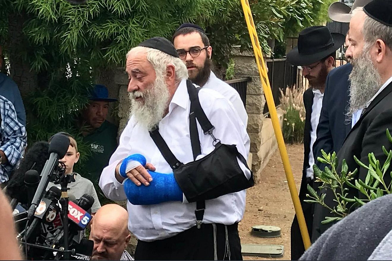 Rabbi Yisroel Goldstein lost his right index finger in the synagogue shooting on April 27, 2018, at Chabad of Poway in Southern California. Source: Twitter.
