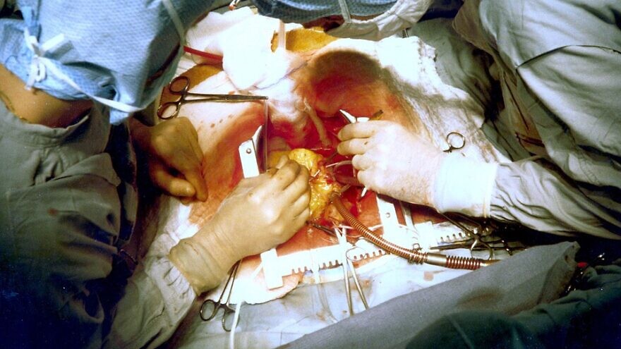 Heart-Surgery-880x495.jpg