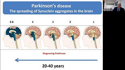 latest research parkinson's disease