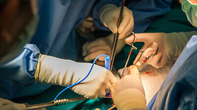 A view of a kidney transplant surgery. Credit: chaiyawat chaidet/Shutterstock.