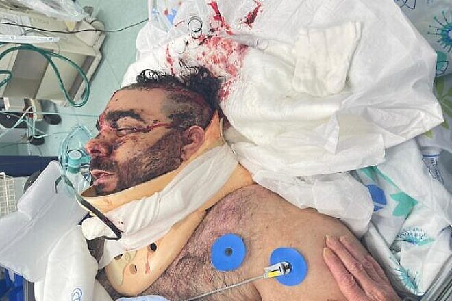 Mor Ganashvili in the hospital, soon after he was attacked, May 2021. Credit: Courtesy.
