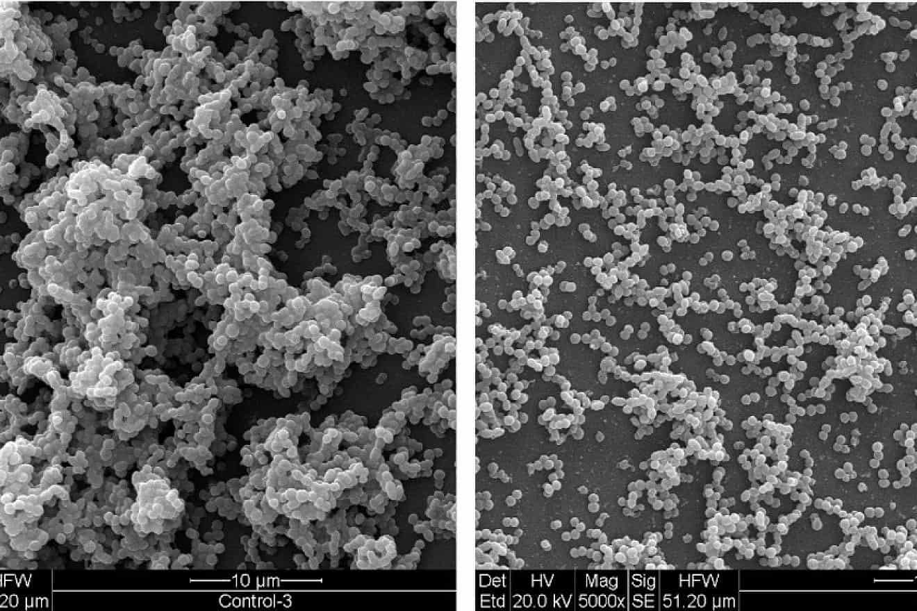A scanning electron microscope (SEM) view of the surface morphology of biofilm formed by S. mutans after 24 hours untreated (left) and treated (right) with 0.5 M DIM. Images are shown at 5,000 magnification. Photos by Ariel Kushmaro.