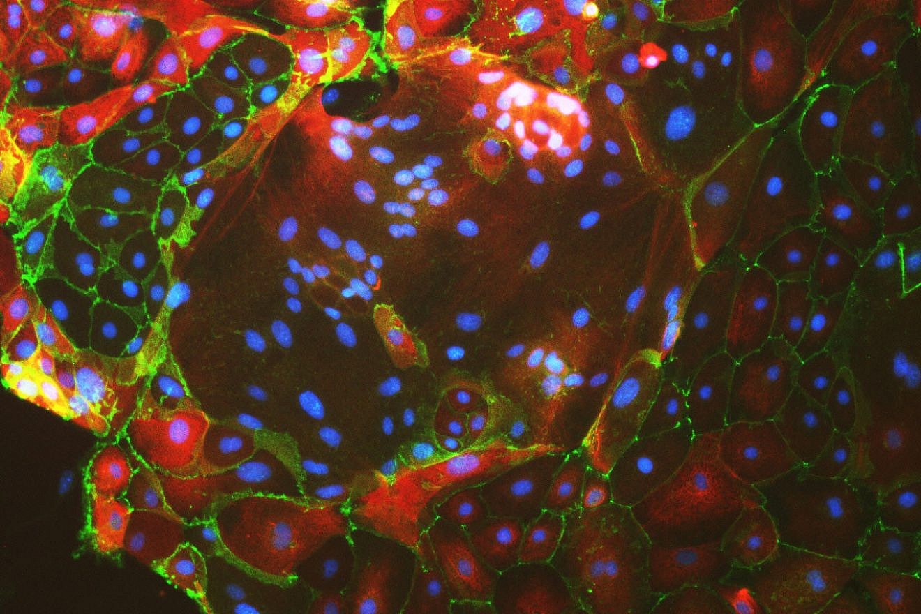 Placenta multinucleated cells. Credit: Moriyah Naama/Buganim Lab.